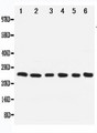 NOL3 / ARC Antibody - WB of NOL3 / ARC antibody. All lanes: Anti-NOL3 at 0.5ug/ml. Lane 1: SMMC Whole Cell Lysate at 40ug. Lane 2: A549 Whole Cell Lysate at 40ug. Lane 3: U87 Whole Cell Lysate at 40ug. Lane 4: HELA Whole Cell Lysate at 40ug. Lane 5: MCF-7 Whole Cell Lysate at 40ug. Lane 6: Rat Liver Tissue Lysate at 40ug. Predicted bind size: 24KD. Observed bind size: 24KD.