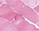 NOL3 / ARC Antibody - Immunohistochemistry of ARC in human skeletal muscle with ARC antibody at 5 ug/ml.