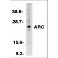 NOL3 / ARC Antibody - Western blot analysis of ARC in HeLa whole cell lysates with ARC antibody at 1:500 dilution.