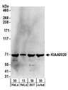 NOP14 / C4orf9 Antibody - Detection of human KIAA0020 by western blot. Samples: Whole cell lysate from HeLa (15 and 50 µg), HEK293T (50µg), and Jurkat (50µg) cells. Antibodies: Affinity purified rabbit anti-KIAA0020 antibody used for WB at 0.1 µg/ml. Detection: Chemiluminescence with an exposure time of 3 minutes.