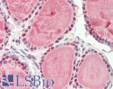 Nor-1 / NR4A3 Antibody - Human Thyroid: Formalin-Fixed, Paraffin-Embedded (FFPE).  This image was taken for the unconjugated form of this product. Other forms have not been tested.