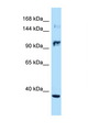 NOS2 / iNOS Antibody - NOS2 antibody Western blot of Jurkat Cell lysate. Antibody concentration 1 ug/ml.  This image was taken for the unconjugated form of this product. Other forms have not been tested.