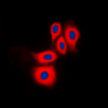 NOS3 / eNOS Antibody - Immunofluorescent analysis of eNOS (pS1177) staining in HUVEC cells. Formalin-fixed cells were permeabilized with 0.1% Triton X-100 in TBS for 5-10 minutes and blocked with 3% BSA-PBS for 30 minutes at room temperature. Cells were probed with the primary antibody in 3% BSA-PBS and incubated overnight at 4 C in a humidified chamber. Cells were washed with PBST and incubated with a DyLight 594-conjugated secondary antibody (red) in PBS at room temperature in the dark. DAPI was used to stain the cell nuclei (blue).