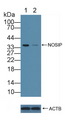 NOSIP Antibody - Knockout Varification: Lane 1: Wild-type 293T cell lysate; Lane 2: NOSIP knockout 293T cell lysate; Predicted MW: 33kd Observed MW: 35kd Primary Ab: 5µg/ml Rabbit Anti-Human NOSIP Antibody Second Ab: 0.2µg/mL HRP-Linked Caprine Anti-Rabbit IgG Polyclonal Antibody