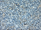 NOTCH1 Antibody - IHC of paraffin-embedded pancreas using anti-Notch1 mouse monoclonal antibody.
