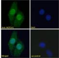 NOTCH1 Antibody - Immunofluorescence analysis of paraformaldehyde fixed U2OS cells, permeabilized with 0.15% Triton. Primary incubation 1hr (5ug/ml) followed by Alexa Fluor 488 secondary antibody (2ug/ml), showing nuclear staining. The nuclear stain is DAPI (blue). Negative control: Unimmunized goat IgG (5ug/ml) followed by Alexa Fluor 488 secondary antibody (2ug/ml).