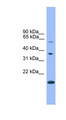 NOTCH4 Antibody - NOTCH4 antibody Western blot of Jurkat lysate. This image was taken for the unconjugated form of this product. Other forms have not been tested.