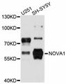NOVA1 Antibody - Western blot analysis of extracts of various cell lines, using NOVA1 antibody at 1:3000 dilution. The secondary antibody used was an HRP Goat Anti-Rabbit IgG (H+L) at 1:10000 dilution. Lysates were loaded 25ug per lane and 3% nonfat dry milk in TBST was used for blocking. An ECL Kit was used for detection and the exposure time was 1s.