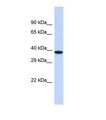 NOX4 Antibody - Western blot of Human MCF7. NOX4 antibody dilution 1.0 ug/ml.  This image was taken for the unconjugated form of this product. Other forms have not been tested.