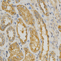 NOX4 Antibody - Immunohistochemistry of paraffin-embedded human kidney using NOX4 antibody at dilution of 1:200 (x400 lens)