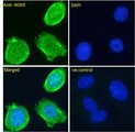 NOX5 Antibody - NOX5 antibody immunofluorescence analysis of paraformaldehyde fixed MCF7 cells, permeabilized with 0.15% Triton. Primary incubation 1hr (10ug/ml) followed by Alexa Fluor 488 secondary antibody (2ug/ml), showing vesicle staining. The nuclear stain is DAPI (blue).