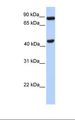 NPAS2 Antibody - Transfected 293T cell lysate. Antibody concentration: 1.0 ug/ml. Gel concentration: 12%.  This image was taken for the unconjugated form of this product. Other forms have not been tested.