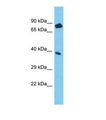 NPEPL1 Antibody - Western blot of Human ACHN. NPEPL1 antibody dilution 1.0 ug/ml.  This image was taken for the unconjugated form of this product. Other forms have not been tested.