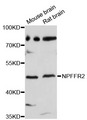 NPFF2 / NPFFR2 Antibody - Western blot analysis of extracts of various cell lines, using NPFFR2 antibody at 1:3000 dilution. The secondary antibody used was an HRP Goat Anti-Rabbit IgG (H+L) at 1:10000 dilution. Lysates were loaded 25ug per lane and 3% nonfat dry milk in TBST was used for blocking. An ECL Kit was used for detection and the exposure time was 90s.