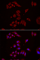 NPHP1 / Nephronophthisis Antibody - Immunofluorescence analysis of U2OS cell using NPHP1 antibody. Blue: DAPI for nuclear staining.