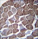 NPHP3 Antibody - NPHP3 Antibody immunohistochemistry of formalin-fixed and paraffin-embedded human skeletal muscle followed by peroxidase-conjugated secondary antibody and DAB staining.
