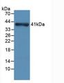 NPHS1 / Nephrin Antibody