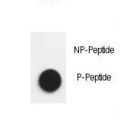 NPHS1 / Nephrin Antibody - Dot blot of anti-Phospho-Nephrin (Y1193) antibody Phospho-specific antibody on nitrocellulose membrane. 50ng of Phospho-peptide or Non Phospho-peptide per dot were adsorbed. Antibody working concentrations are 0.6ug per ml.