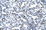 NPM1 / NPM / Nucleophosmin Antibody - NPM1 antibody ARP34094_T100-NP_002511-NPM1 (nucleophosmin (nucleolar phosphoprotein B23, numatrin)) Antibody IHC of formalin-fixed, paraffin-embedded human Lung. Positive label: Alveolar cells indicated with arrows. Antibody concentration 4-6 ug/ml. Magnification 400X.  This image was taken for the unconjugated form of this product. Other forms have not been tested.