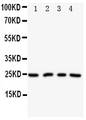 NPM2 Antibody - Anti-NPM2 antibody, Western blotting Lane 1: HELA Cell LysateLane 2: U87 Cell LysateLane 3: A549 Cell LysateLane 4: SMMC Cell Lysate