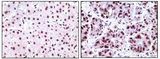 NPM2 Antibody - NPM1 Antibody in Immunohistochemistry (IHC)