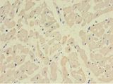 NPPB / BNP Antibody - Immunohistochemistry of paraffin-embedded human heart tissue using antibody at 1: 100 dilution.  This image was taken for the unconjugated form of this product. Other forms have not been tested.