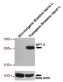 NPT II Antibody - Western blot detection of NPTII in non-transgenic Brassica napus L. and transgenic Brassica napus L. cell lysates using NPTII mouse monoclonal antibody (1:1000 dilution). Predicted band size: 29KDa. Observed band size:29KDa.