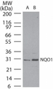NQO1 Antibody - Western blot of NQO1 in kidney lysate.  Lane 1 shows pre-immune sera and lane 2 show antibody tested on human kidney at 1:2500 dilution.