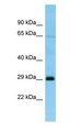 NQO2 Antibody - NQO2 antibody Western Blot of THP-1.  This image was taken for the unconjugated form of this product. Other forms have not been tested.