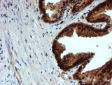 NQO2 Antibody - IHC of paraffin-embedded Human prostate tissue using anti-NQO2 mouse monoclonal antibody. (Heat-induced epitope retrieval by 10mM citric buffer, pH6.0, 100C for 10min).