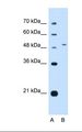NR0B1 / DAX1 Antibody - Lane A: Marker. Lane B: HepG2 cell lysate. Antibody concentration: 0.5 ug/ml. Gel concentration: 12%.  This image was taken for the unconjugated form of this product. Other forms have not been tested.