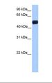 NR0B1 / DAX1 Antibody - Transfected 293T cell lysate. Antibody concentration: 1.0 ug/ml. Gel concentration: 12%.  This image was taken for the unconjugated form of this product. Other forms have not been tested.