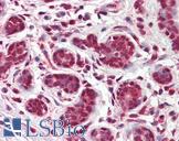 NR1A2 / THRB Antibody - Human Breast: Formalin-Fixed, Paraffin-Embedded (FFPE)