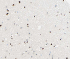 NR1A2 / THRB Antibody - 1:100 staining human brain tissue by IHC-P. The tissue was formaldehyde fixed and a heat mediated antigen retrieval step in citrate buffer was performed. The tissue was then blocked and incubated with the antibody for 1.5 hours at 22°C. An HRP conjugated goat anti-rabbit antibody was used as the secondary.