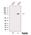 NR1D2 Antibody - Western blot analysis of extracts of HeLa cells using NR1D2 antibody. The lane on the left was treated with blocking peptide.