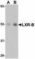 NR1H2 / LXR Beta Antibody - Western blot of LXR-B in human lung tissue lysate with LXR-B antibody at (A) 1 and (B) 2 ug/ml.