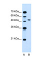 NR1I2 / PXR Antibody - NR1I2 / PXR antibody ARP39738_T100-NP_003880-NR1I2(nuclear receptor subfamily 1, group I, member 2) Antibody Western blot of Jurkat lysate.  This image was taken for the unconjugated form of this product. Other forms have not been tested.