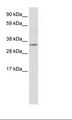 NR1I3 / CAR Antibody - NIH 3T3 Cell Lysate.  This image was taken for the unconjugated form of this product. Other forms have not been tested.