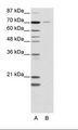 NR2C1 Antibody - A: Marker, B: HCTI 5 Cell Lysate.  This image was taken for the unconjugated form of this product. Other forms have not been tested.