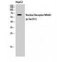 NR4A1 / NUR77 Antibody - Western blot of Phospho-Nur77 (S351) antibody