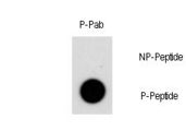 NR4A1 / NUR77 Antibody - Dot blot of Phospho-NR4A1-S351 polyclonal antibody on nitrocellulose membrane. 50ng of Phospho-peptide or Non Phospho-peptide per dot were adsorbed. Antibody working concentration was 0.5ug per ml. P-antibody: phospho-antibody; P-Peptide: phospho-peptide; NP-Peptide: non-phospho-peptide.