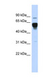 NR4A2 / NURR1 Antibody - NR4A2 / NURR1 antibody Western blot of Fetal Liver lysate. This image was taken for the unconjugated form of this product. Other forms have not been tested.