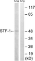 NR5A1 / SF1 Antibody - Western blot analysis of lysates from rat lung, using STF-1 Antibody. The lane on the right is blocked with the synthesized peptide.