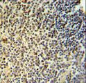 NR5A1 / SF1 Antibody - NR5A1 Antibody IHC of formalin-fixed and paraffin-embedded human spleen tissue followed by peroxidase-conjugated secondary antibody and DAB staining.