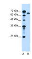 NR5A2 / LRH-1 Antibody - NR5A2 antibody ARP38386_T100-NP_995582-NR5A2(nuclear receptor subfamily 5, group A, member 2) Antibody Western blot of HepG2 cell lysate.  This image was taken for the unconjugated form of this product. Other forms have not been tested.