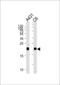 NRAS / N-ras Antibody - NRAS Antibody western blot of A431 and rat C6 cell line lysates (35 ug/lane). The NRAS antibody detected the NRAS protein (arrow).