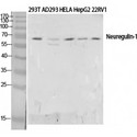 NRG1 / Heregulin / Neuregulin Antibody - Western blot of Neuregulin-1 antibody