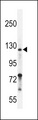 NRP2 / Neuropilin 2 Antibody - Neuropilin-2 Antibody (C-term K813) western blot of ZR-75-1 cell line lysates (35 ug/lane). The Neuropilin-2 antibody detected the Neuropilin-2 protein (arrow).