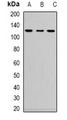 NRP2 / Neuropilin 2 Antibody - Western blot analysis of Neuropilin 2 expression in 293T (A); NIH3T3 (B); PC12 (C) whole cell lysates.