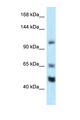 NRSF / REST Antibody - REST antibody Western blot of Mouse Heart lysate. Antibody concentration 1 ug/ml.  This image was taken for the unconjugated form of this product. Other forms have not been tested.